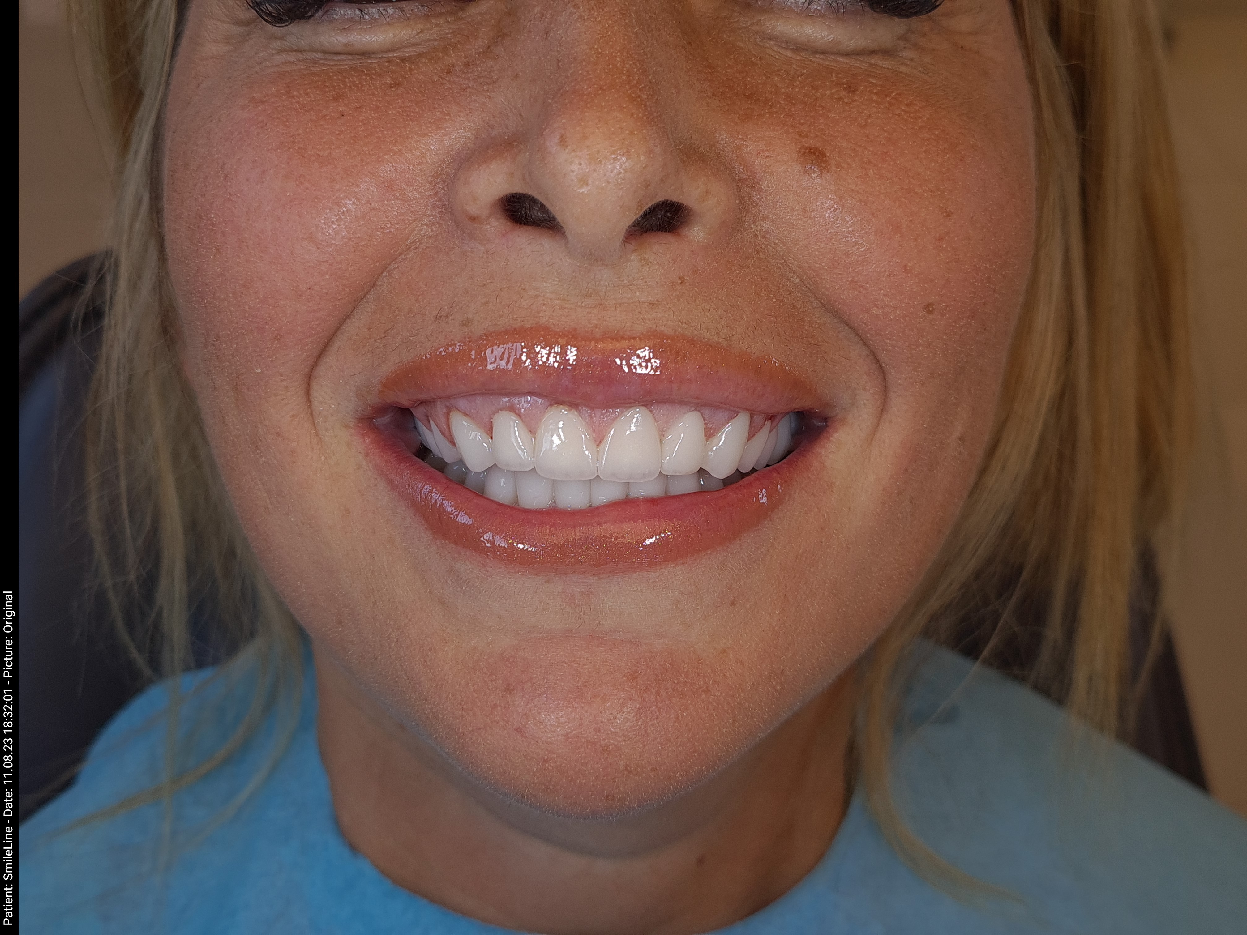 Before