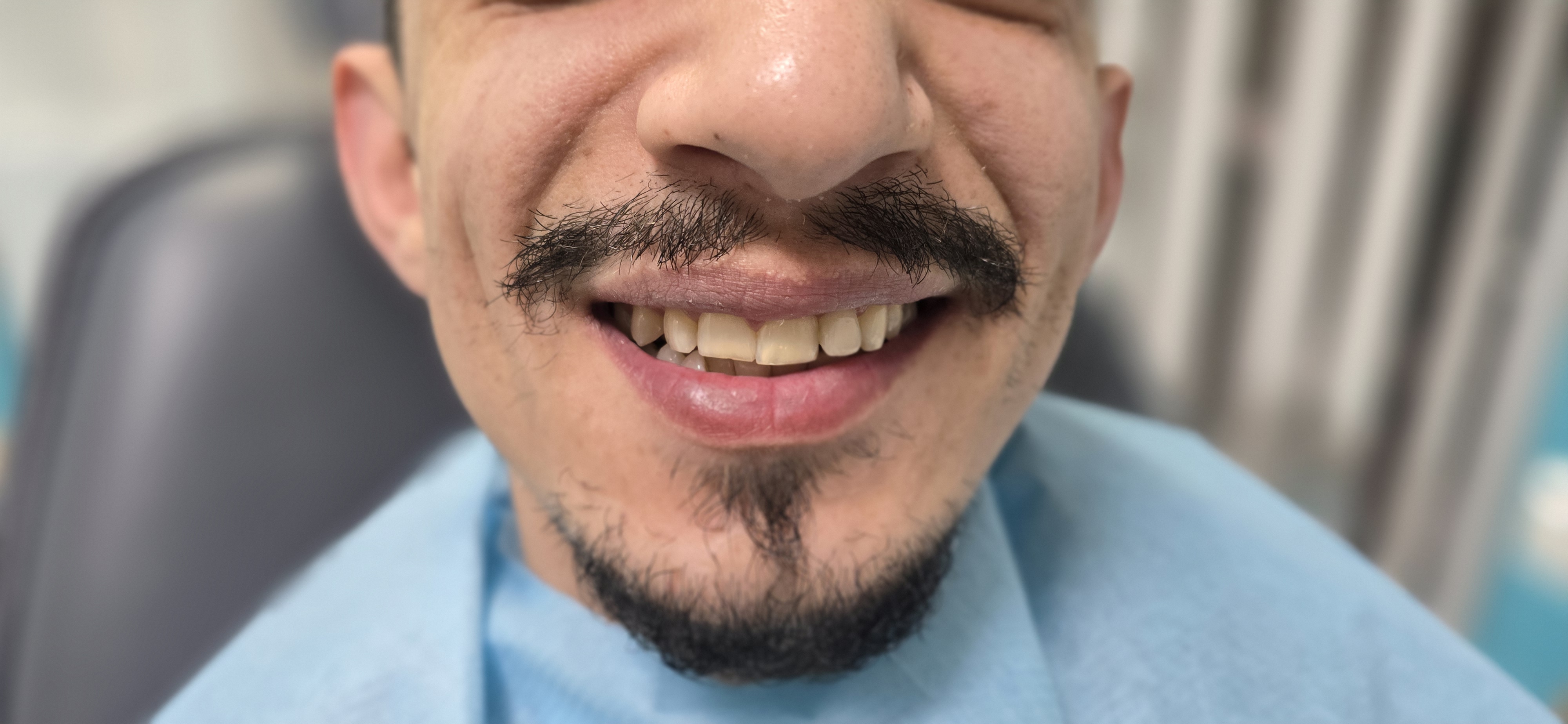 After