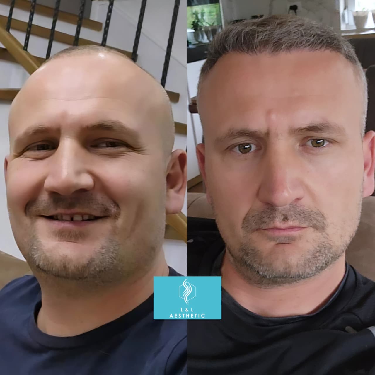 Plastic Surgery