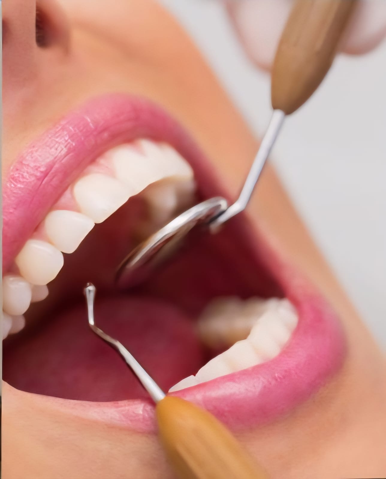 Dental Check-up