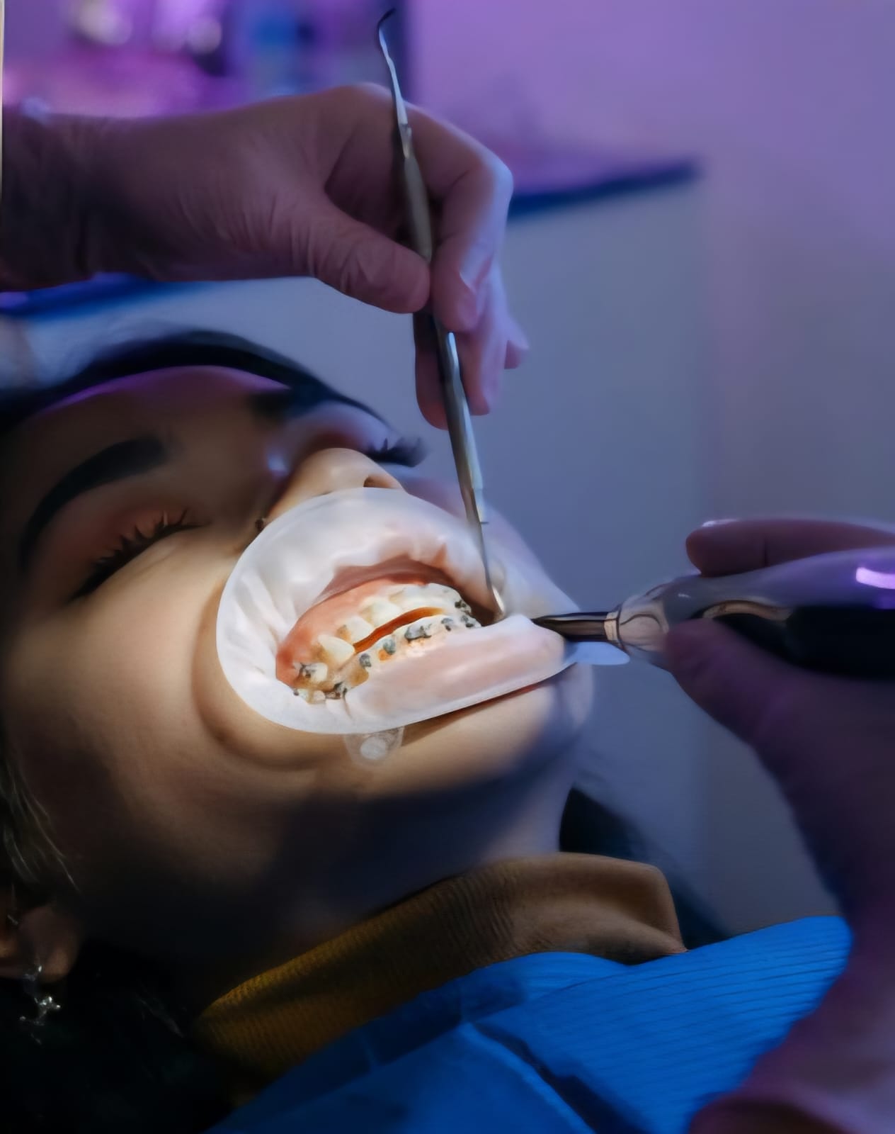 Prosthetic Process