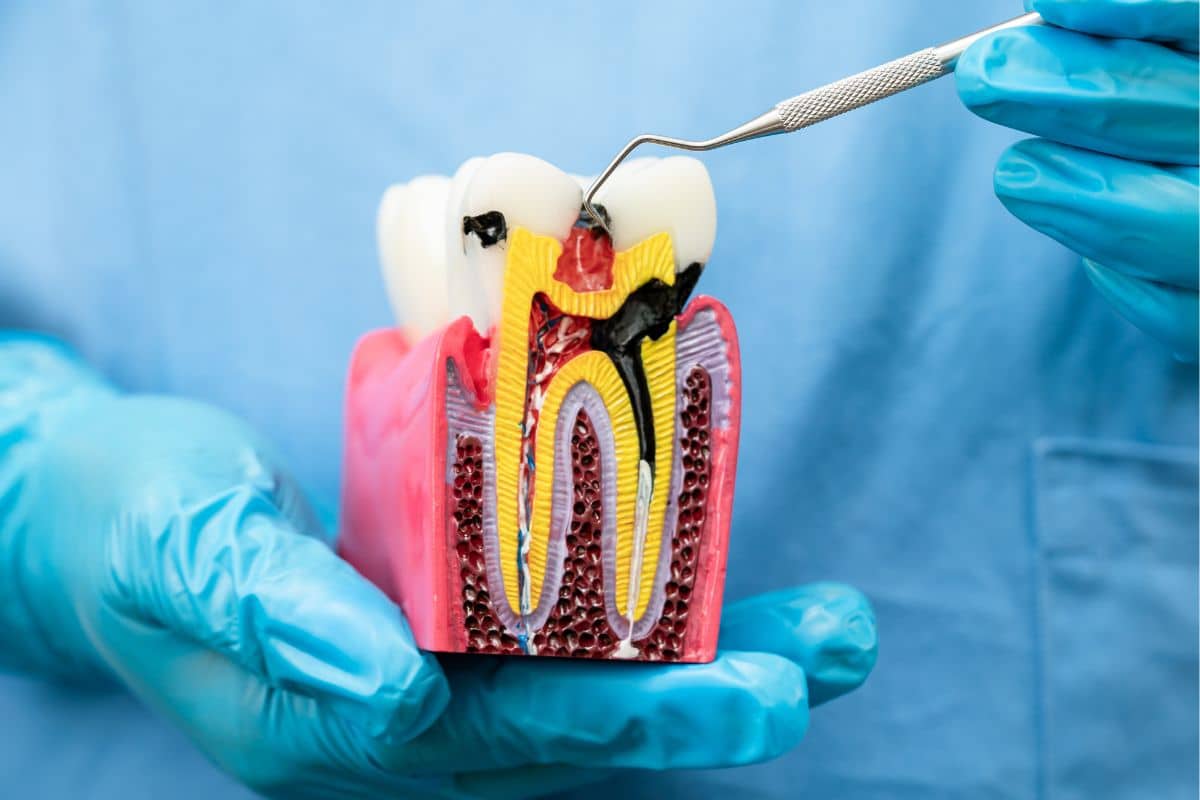Endodontics